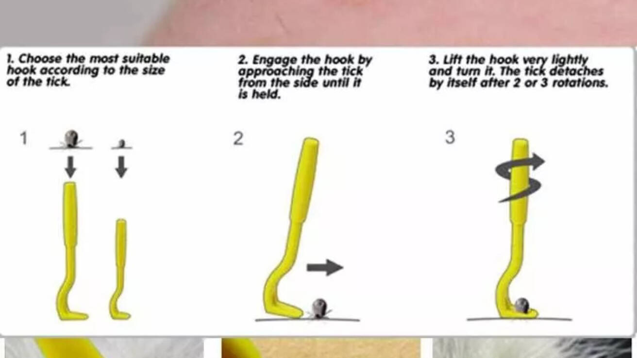 Tick hook